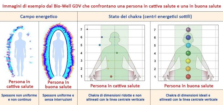 Immagini di esempio dal Bio-Well GDV che confrontano una persona in cattiva salute e una in buona salute