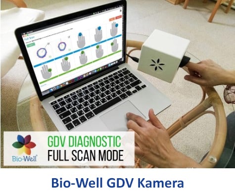 Bio-Well GDV Kamera