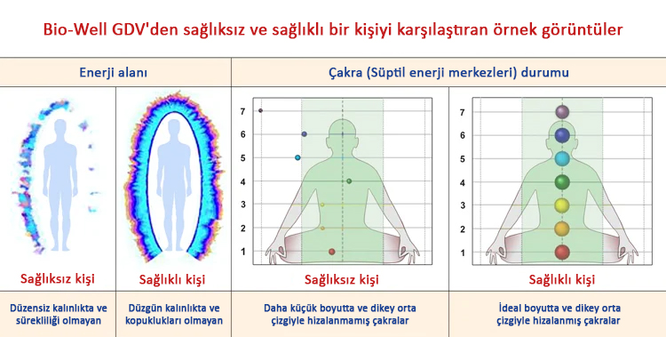 Bio-Well GDV'den sağlıksız ve sağlıklı bir kişiyi karşılaştıran örnek görüntüler