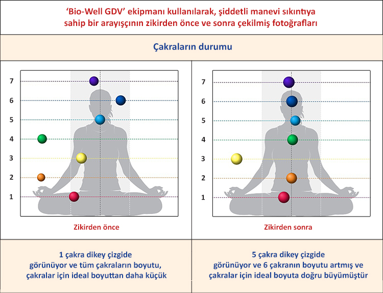 'Bio-Well GDV' ekipmanı kullanılarak, şiddetli manevi sıkıntıya sahip bir arayışçının zikirden önce ve sonra çekilmiş fotoğrafları