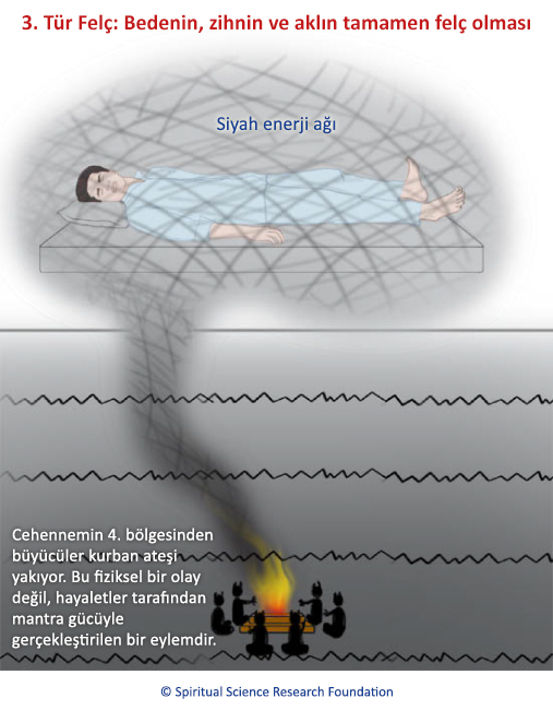 3. Tür Felç: Bedenin, zihnin ve aklın tamamen felç olması