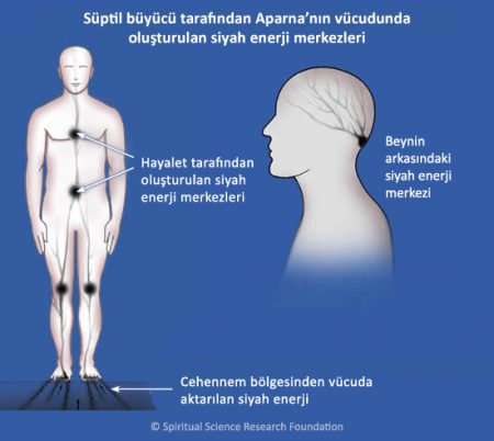 Kronik migren – manevi tedavi