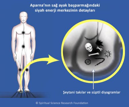 Kronik migren – manevi tedavi