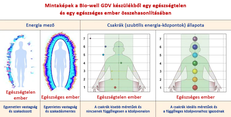 Mintaképek a Bio-well GDV készülékből egy egészségtelen és egy egészséges ember összehasonlításában